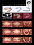 ‘Orthodontic Treatments Using Directly 3D-Printed Clear Aligners’ published in the Journal of Clinical Orthodontics on October 2023 (Graphic: Business Wire)