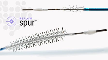 The Bare Temporary Spur Stent System is a unique clinical solution known as Retrievable Stent Therapy, or RST. It is intended to provide stent-like results while leaving no metal behind. (Graphic: Business Wire)