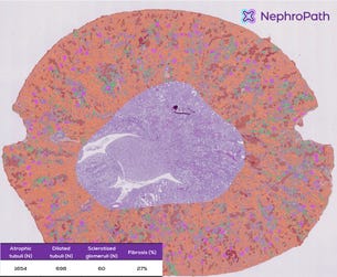 Figure 1. Illustration of the NephroPath platform’s capabilities in performing automated quantification and multi-class prediction on an entire rat kidney cortex. Notable classes: normal tubuli (orange), atrophic/dilated tubuli (green/red), glomeruli (pink), abnormal/sclerotic glomeruli (dark blue), arteries (light blue), interstitium (not colored). (Photo: Business Wire)