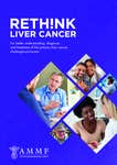 AMMF’s Rethink Liver Cancer report reveals significant inequalities in access to treatment and survival rates for NHS patients with cholangiocarcinoma