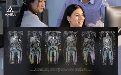 Credit: Collaboration with Dr. Ian J Neeland, University Hospitals Cleveland. Data from NCT03038620 (ClinicalTrials.gov identifier) analysed with AMRA® Researcher