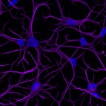 bit.bio launches ioAstrocytes, advancing how scientists can model the human brain (Photo: Business Wire)