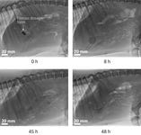 Fluoroscopic images of the abdomen of a dog at various times after administering an Enzian dosage form. Initially, the dosage form was unimpaired in the stomach. Then it expanded due to gastric fluid absorption and formed a viscoelastic gel that resided in the stomach for prolonged time. By 45 hours the dosage form was fragmented in the intestine. By 48 hours it was entirely dissolved. The animal experiments were conducted at the Diagnostic Imaging Research Unit (DIRU), University of Zurich, led by Dr. Henning Richter. The images are adapted from A.H. Blaesi et al. Int. J. Pharm. (2022) 120792 https://doi.org/10.1016/j.ijpharm.2021.120792. The work received financial support from the innovation agency of the government of Switzerland (Innosuisse). (Photo: Business Wire)