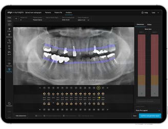 Align X-ray Insights, an AI Computer-Aided Detection Software (Photo: Business Wire)