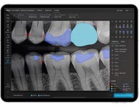 Align X-ray Insights, an AI Computer-Aided Detection Software (Photo: Business Wire)