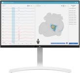 vMap is a non-invasive tool developed with AI that transforms standard 12-lead ECG data into 3D arrhythmia source maps in under a minute.