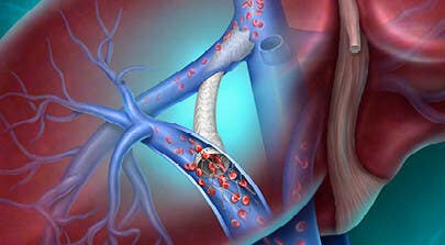 PR Newswire associated0