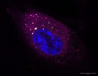 BK virus infected human kidney epithelial cell