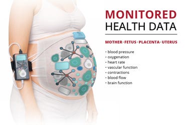 Carnegie Mellon University is leading a multi-university team that has secured an award of up to $39.3 million from the Advanced Research Projects Agency for Health (ARPA-H) to develop a wearable monitoring system to better identify fetal distress and its cause, enabling a safer labor and delivery experience for mothers and babies.